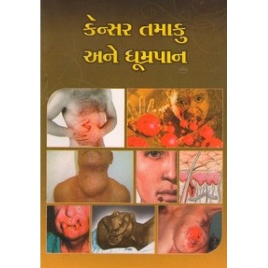 Cancer Tamaku Ane Dhumrapan By Jayanti Patel